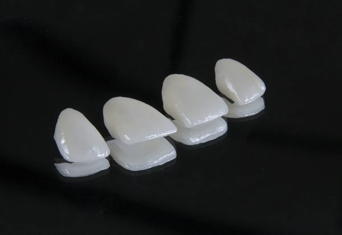 Thin porcelain veneer shells