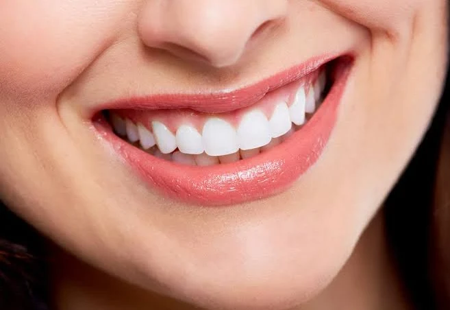 Close-up of a natural, even smile after a smile makeover